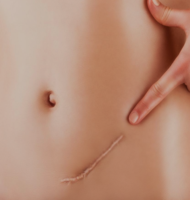 Scars, Skintags, and Dermatology